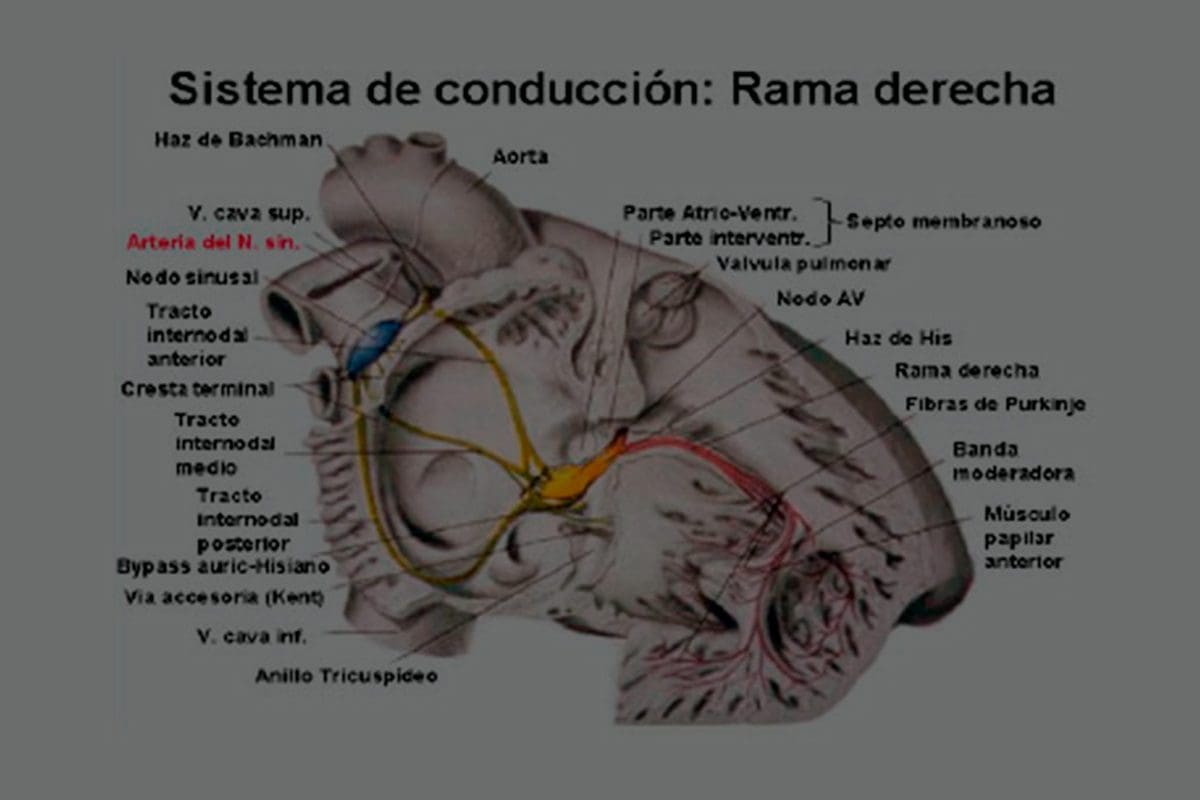 El Estudio Electrofisiológico Cardíaco – Dr. Juan Ramón Fabregat – Dr. José Luis Zacarías Martín