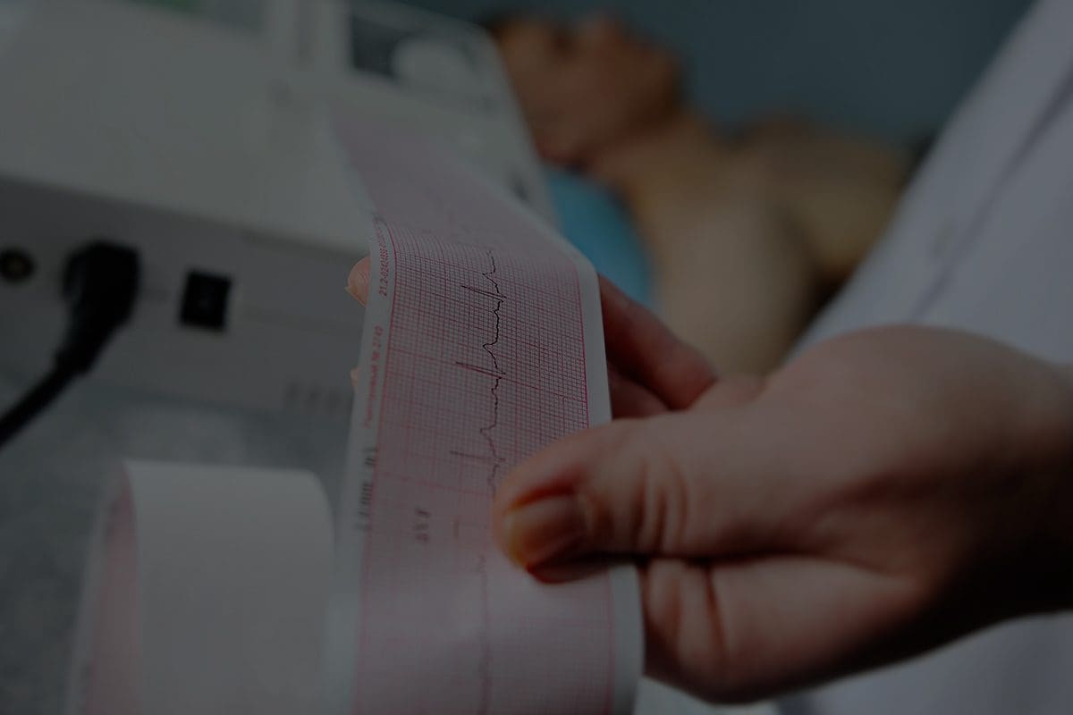 Electrocardiograma,Trasplante Cardíaco Ortotópico por una Miocardiopatía Dilatada Idiopática, Noviembre 2018 – Dr. Gerardo Emilio Pozas Garza